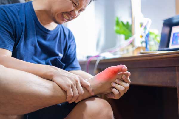 Gejala Asam Urat (ilustrasi) man with painful inflamed gout his foot around big toe area